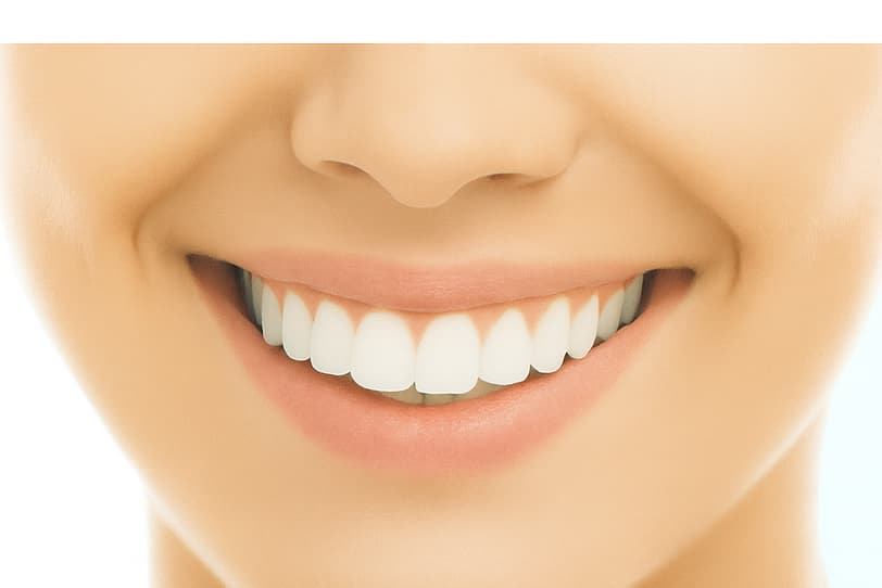 Sorriso di una paziente del Centro Dentale Piovese